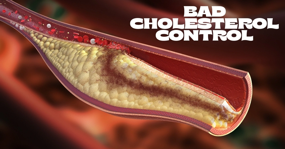 Bad Cholesterol Control